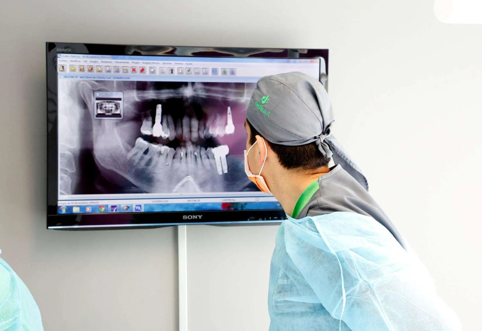 Cbct Tomograf A Computerizada De Haz C Nico Y Aplicaciones En