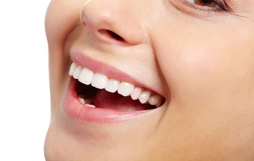 ¿Qué es una funda dental?