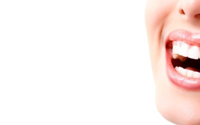 ¿Qué tipos de implantes dentales existen?