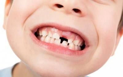 Importancia de los dientes de leche