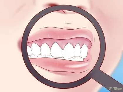 Golpe en los dientes niños Golpe en los dientes niños