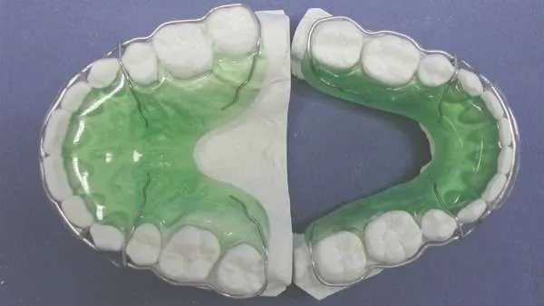 Los Retenedores Dentales Despues De La Ortodoncia Dentisalut