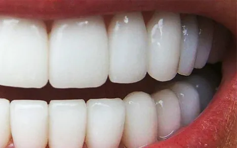 Zirconio en odontología