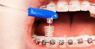Cepillo Interproximal Cepillo Interproximal