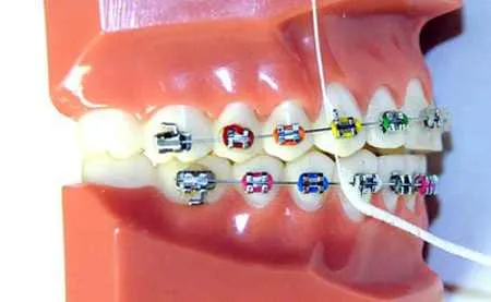 Seda Dental para Ortodoncia