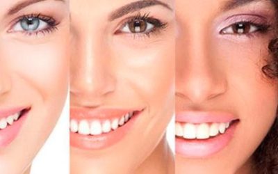 La importancia de los dientes blancos