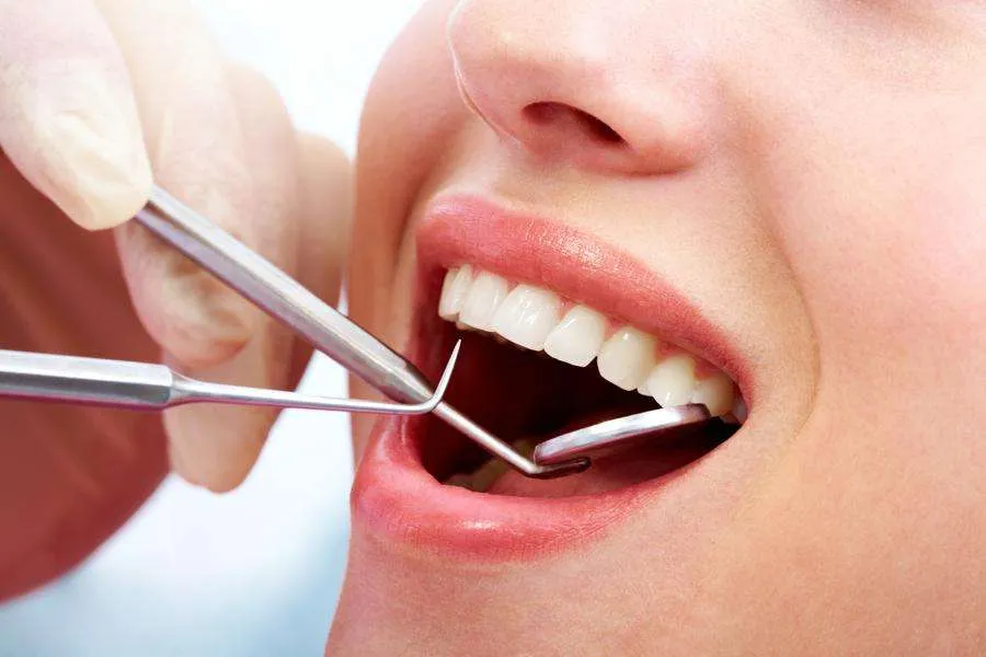 dieta blanca dentisalut blanqueamiento dental
