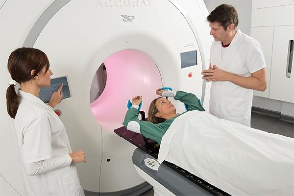 Osteoradionecrosis en maxilar y mandíbula