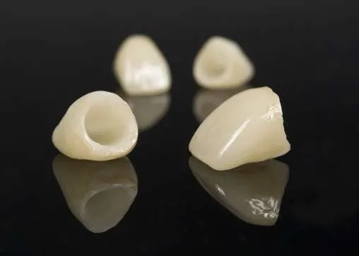 Corona dental en cerámica