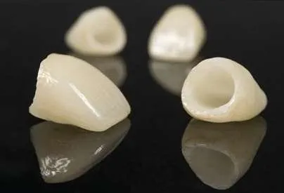 Corona dental de resina