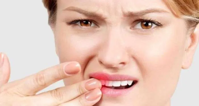 ¿cómo Detectar El Cáncer Oral Dentisalut