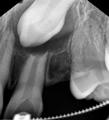 articulo colutorio dentisalut3