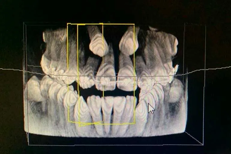 articulo colutorio dentisalut3