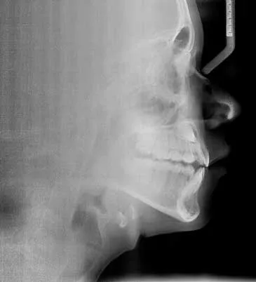 articulo colutorio dentisalut3