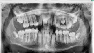 articulo colutorio dentisalut3