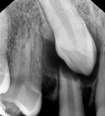 articulo colutorio dentisalut3