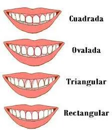 Características generales de los dientes Características generales de los dientes
