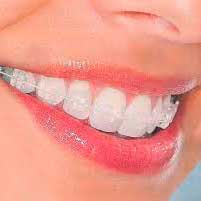 Brackets de ZAFIRO