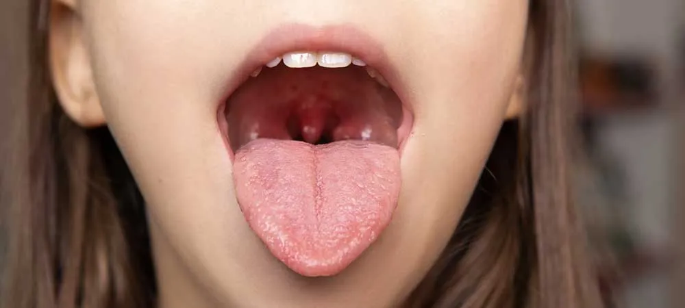 lengua ardiente