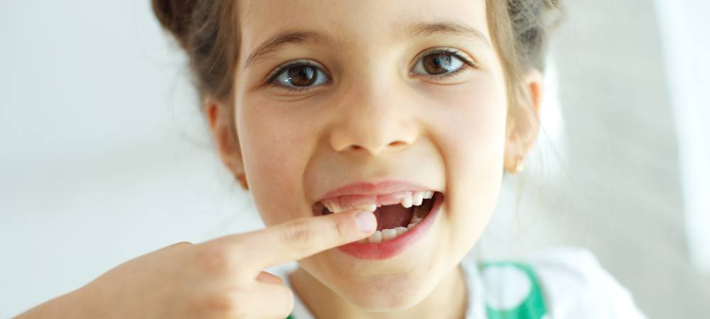 El manejo de la pérdida prematura de dientes temporales en niños requiere un enfoque multidisciplinario que combine tratamientos restaurativos y preventivos. La utilización de mantenedores de espacio es crucial para preservar la alineación dental y permitir que los dientes permanentes erupcionen de manera adecuada. Además, las restauraciones como coronas de acero inoxidable pueden ser necesarias dependiendo de la gravedad del caso. Con un seguimiento adecuado y la implementación de medidas preventivas, es posible minimizar las repercusiones de la pérdida temprana de dientes temporales y asegurar un desarrollo dental saludable para el niño.