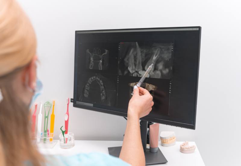 Female dentist is pointing at the screen with radiology film of some teeth.