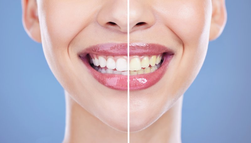 estetica dental mejor