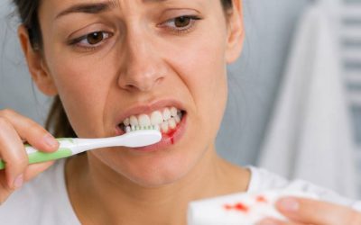 ¿Por qué sangran las encías al cepillarte los dientes?