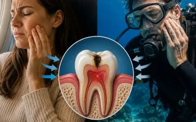 Barodontalgia: ¿Por qué te duelen los dientes cuando buceas o viajas en avión?